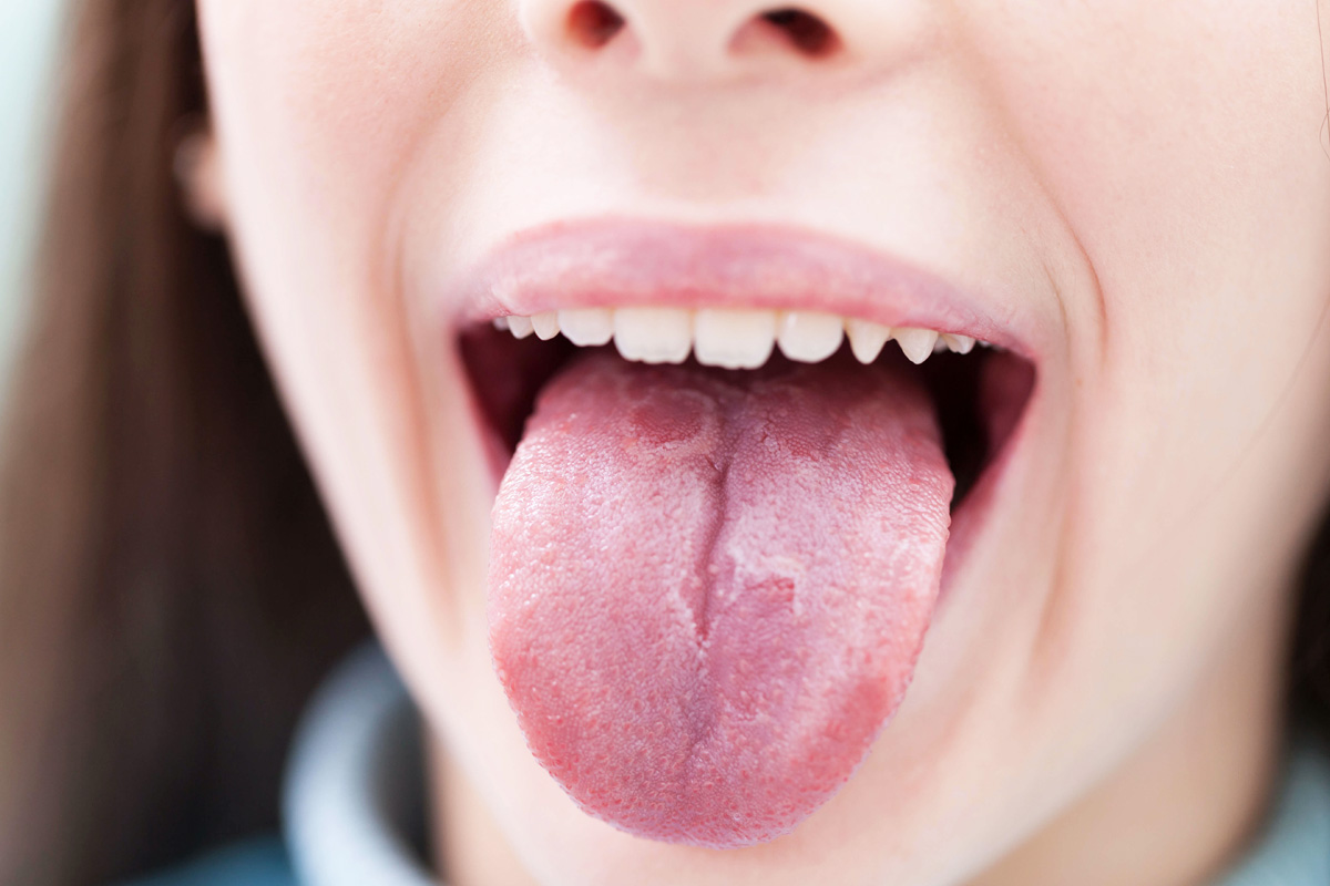 Tongue Problems at Esthetique Dental in keller